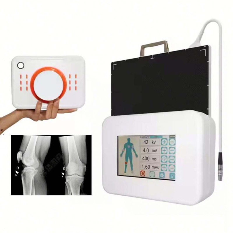Portable Small Size Hand-Held  - огляд і ціна Veterinary X-Ray